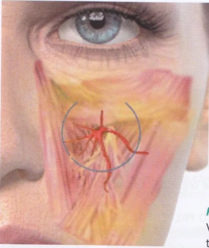 Fig 15. Emergence of the infraorbital bundle