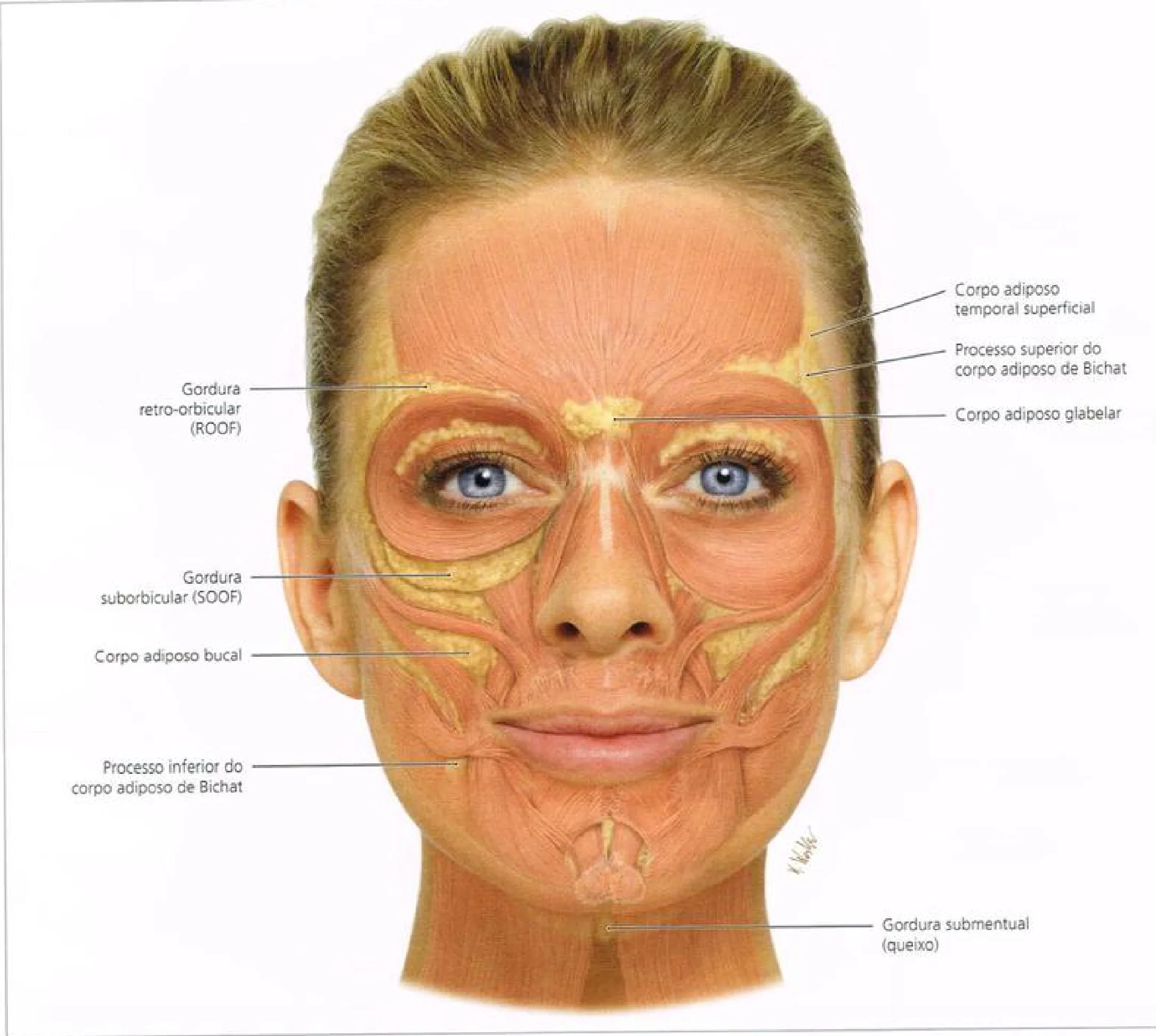 Fig 3. Deep fat bodies of the face, frontal view