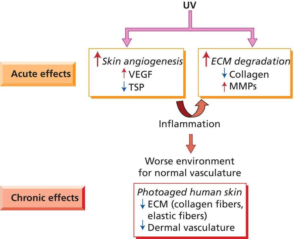 Fig 6. Acute UV effects (angiogenesis, ECM degradation) feeding inflammation and chronic photoaged skin.