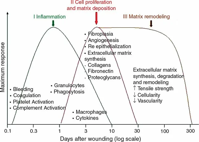 Fig 13. Overlapping wound-healing response curves for inflammation, proliferation and remodeling on a log-time axis.