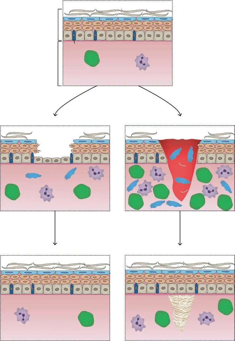 Fig 14. Regeneration versus repair: the same wound resolving to restored architecture or to a collagen scar.