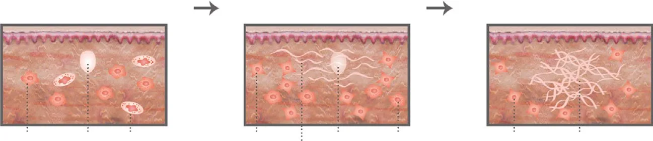 Fig 3. Sequential deposition of dermal collagen fibers by resident cells across three panels.