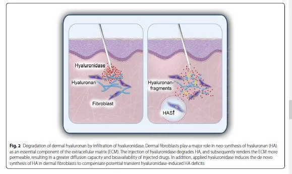 Fig 9. La hialuronidasa degrada también el hialuronano dérmico propio