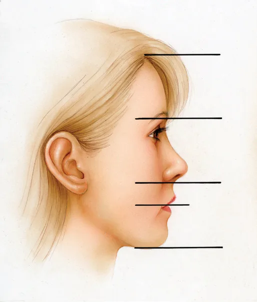 Fig 5. Vertical facial thirds on the profile