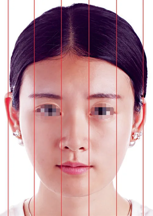 Fig 8. The "five eyes" rule on the frontal view