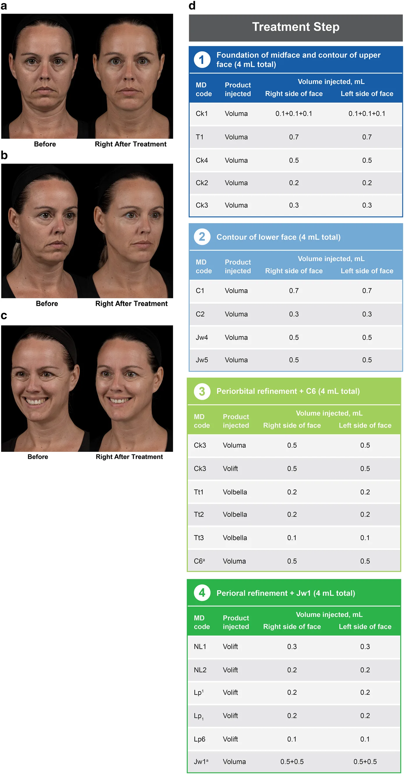Fig 1. MD Codes staged plan — before/after and the coded volume-per-point table