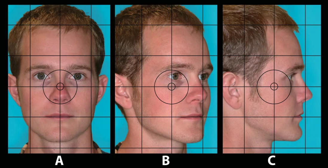 Fig 4. Grid/crosshair focusing screen for reproducible alignment