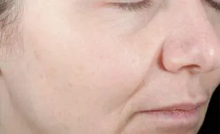 Fig 14. Multi-spectral skin-surface capture — what the device sees vs what you treat