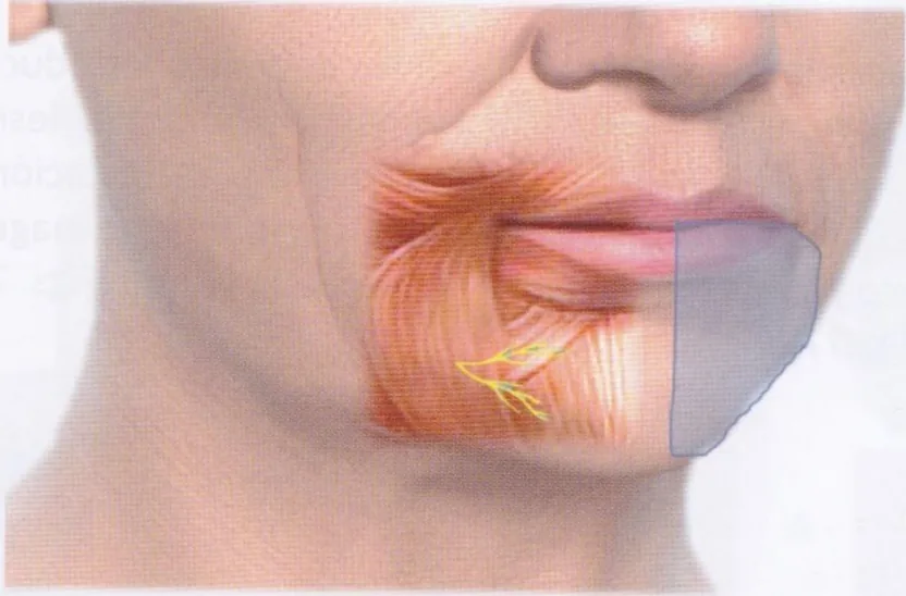 Fig 4. Danger-zone anatomy: the marginal mandibular territory