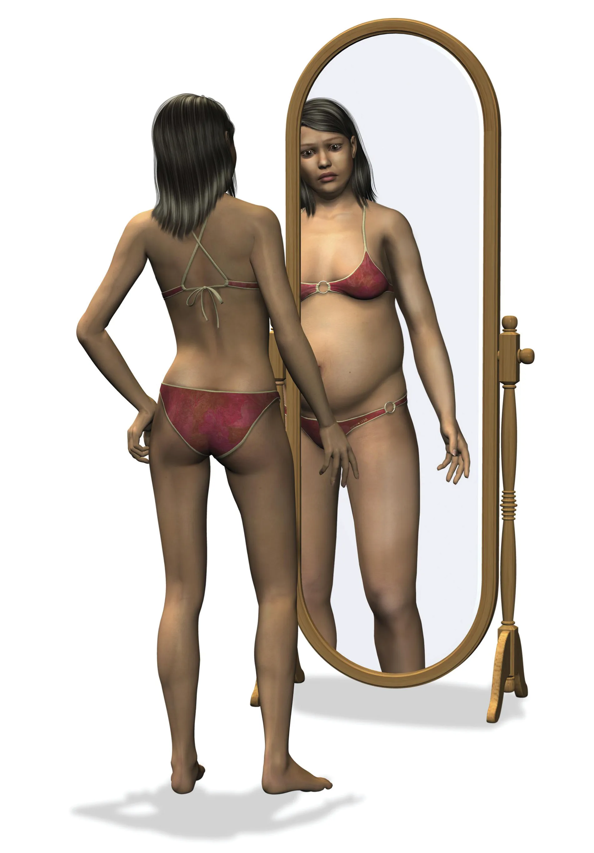 Fig 3. Body-image distortion: a normal-build individual perceiving a heavier, altered self in the mirror, the perceptual mismatch that BDD screens quantify.