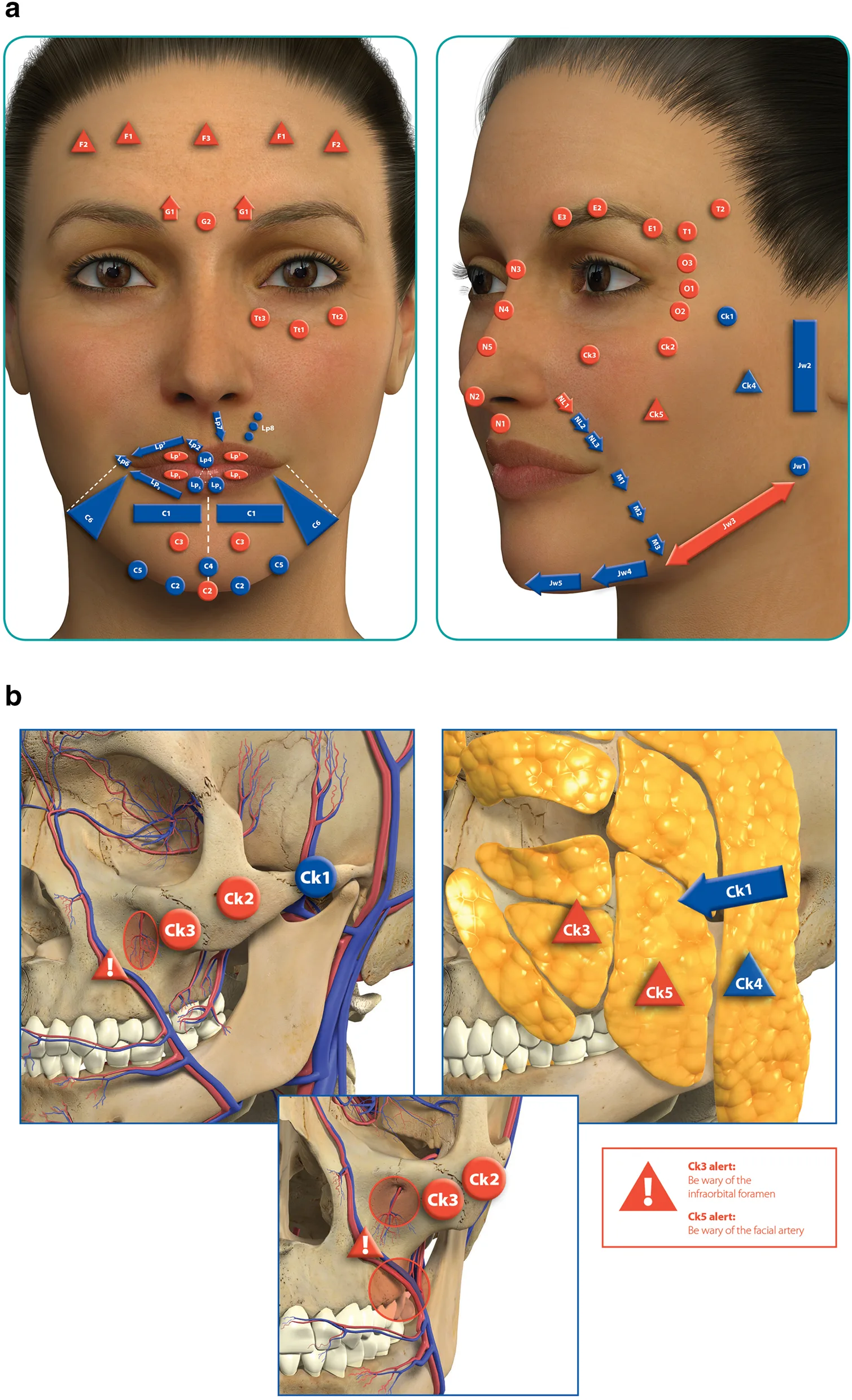 Fig 1. The complete MD Codes™ map: every facial family plotted on frontal and oblique views (a), with anatomical correlates for the cheek codes (b). Circles/triangles/arrows/rectangles encode the delivery tool; red = alert areas.