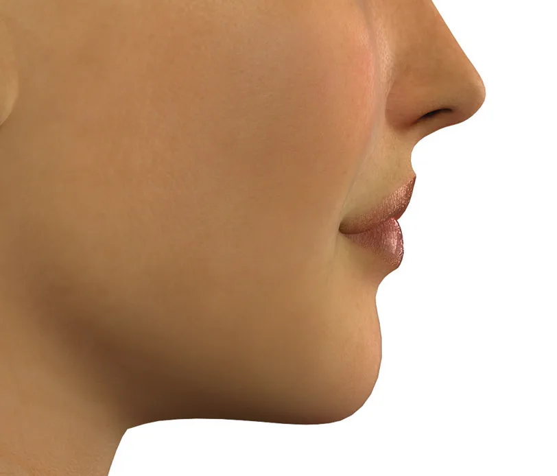 Fig 3. Standardised lateral profile - the view on which the chin is analysed