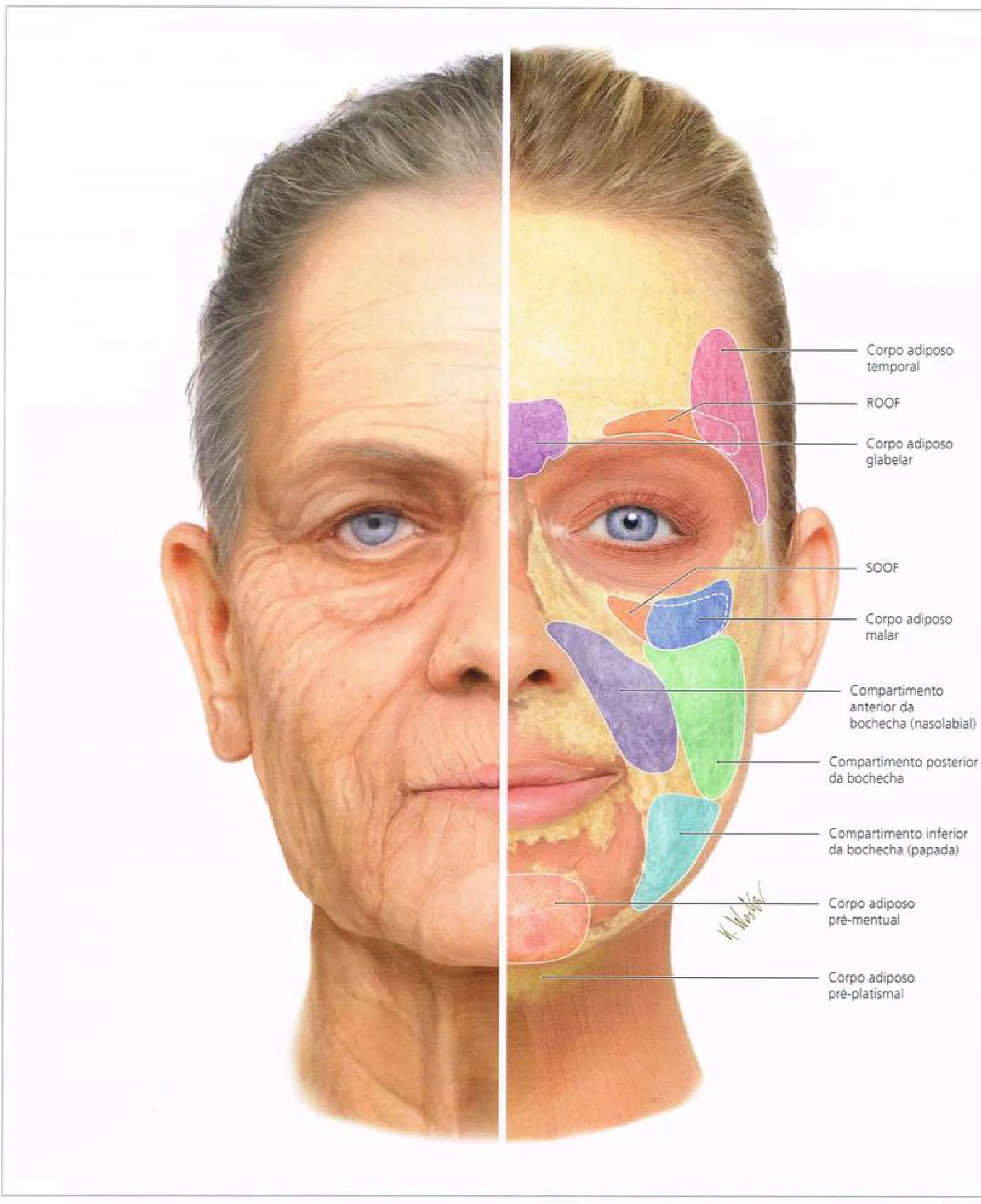 Fig 2. Facial fat compartments, aged (left) versus young (right), with the pre-mental pad labelled