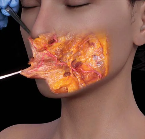 Fig 4. Cadaveric dissection of the lower face with the skin and superficial fat reflected, showing the facial artery ascending over the mandibular border into the cheek.