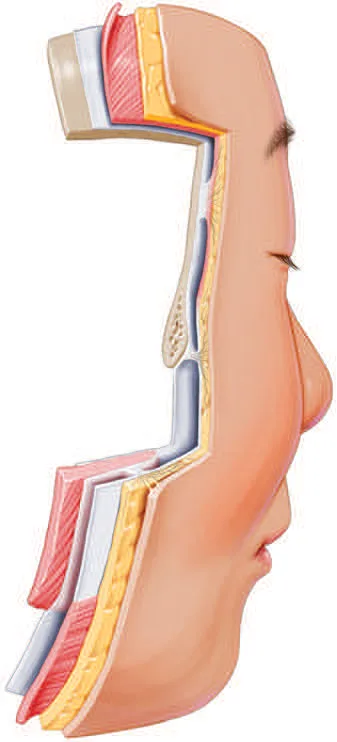 Fig 1. Sagittal layered peel of the forehead into the brow: skin, subcutaneous fat, the musculo-aponeurotic/muscle plane, loose areolar plane, and periosteum, folding over the supraorbital rim.