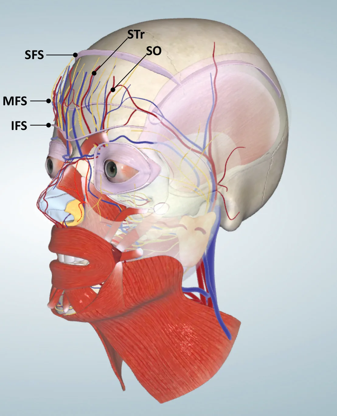 Fig 5. The two forehead arteries (STr, SO) ascending and crossing the superior, middle and inferior frontal septa (SFS/MFS/IFS) from deep to superficial - the anatomical basis of "deep near the rim, superficial up high".