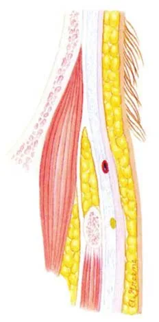 Fig 6. Deep-layer cross-section through the temporal danger zone showing the frontal (temporal) branch of the facial nerve and the frontal branch of the superficial temporal artery between the superficial and deep temporal fascia.