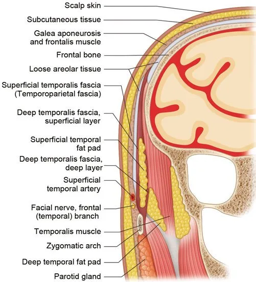 Fig 1. Layered scaffold of the forehead and temporal region: scalp skin, subcutaneous tissue, galea/frontalis, loose areolar tissue, then pericranium over frontal bone; laterally the superficial temporal fascia, the fat pads and the frontal branch of the facial nerve with the superficial temporal artery.