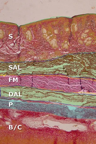 Fig 1. Histological cross-section of the nose: S skin, SAL superficial areolar layer, FM fibromuscular layer, DAL deep areolar layer, P periosteum/perichondrium, over B/C bone/cartilage.