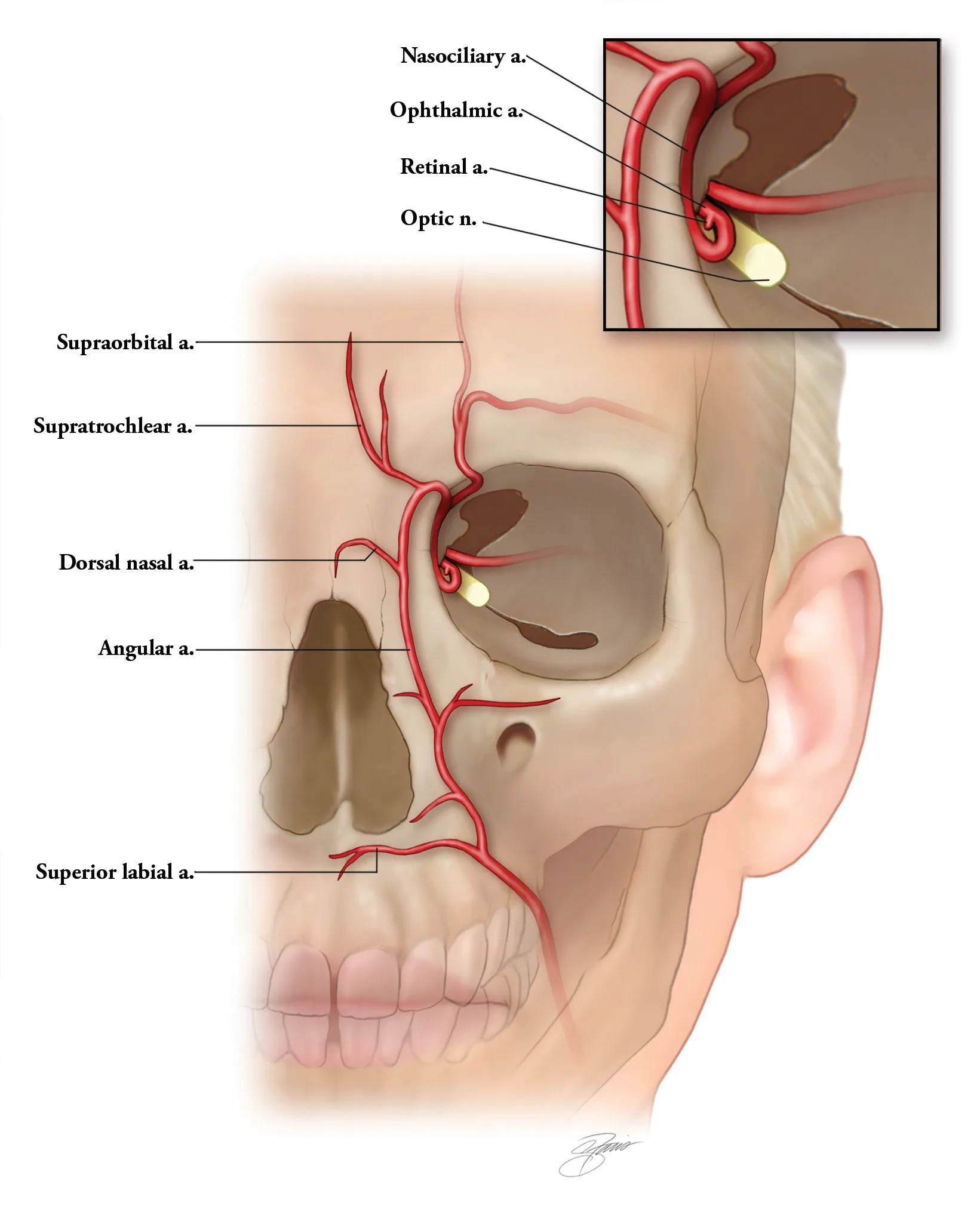 Fig 2. Frontal arterial map of the nose and orbit: dorsal nasal, angular, supraorbital, supratrochlear and superior labial arteries, with the ophthalmic-artery inset (ophthalmic → retinal, optic nerve).