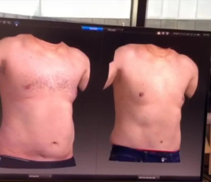 Captura de pantalla de un programa de simulación corporal con dos torsos masculinos renderizados en tres dimensiones, lado a lado. El de la izquierda corresponde al estado actual, con vello torácico y una silueta abdominal llena; el de la derecha es la previsualización, con el abdomen aplanado, el vello eliminado y la ropa interior cambiada. Se aprecian con claridad artefactos de renderizado: los brazos aparecen truncados a la altura del deltoides y hay una prolongación anómala en el hombro derecho de la imagen previsualizada. Material del máster UPO, Competencias digitales, diapositiva 67.